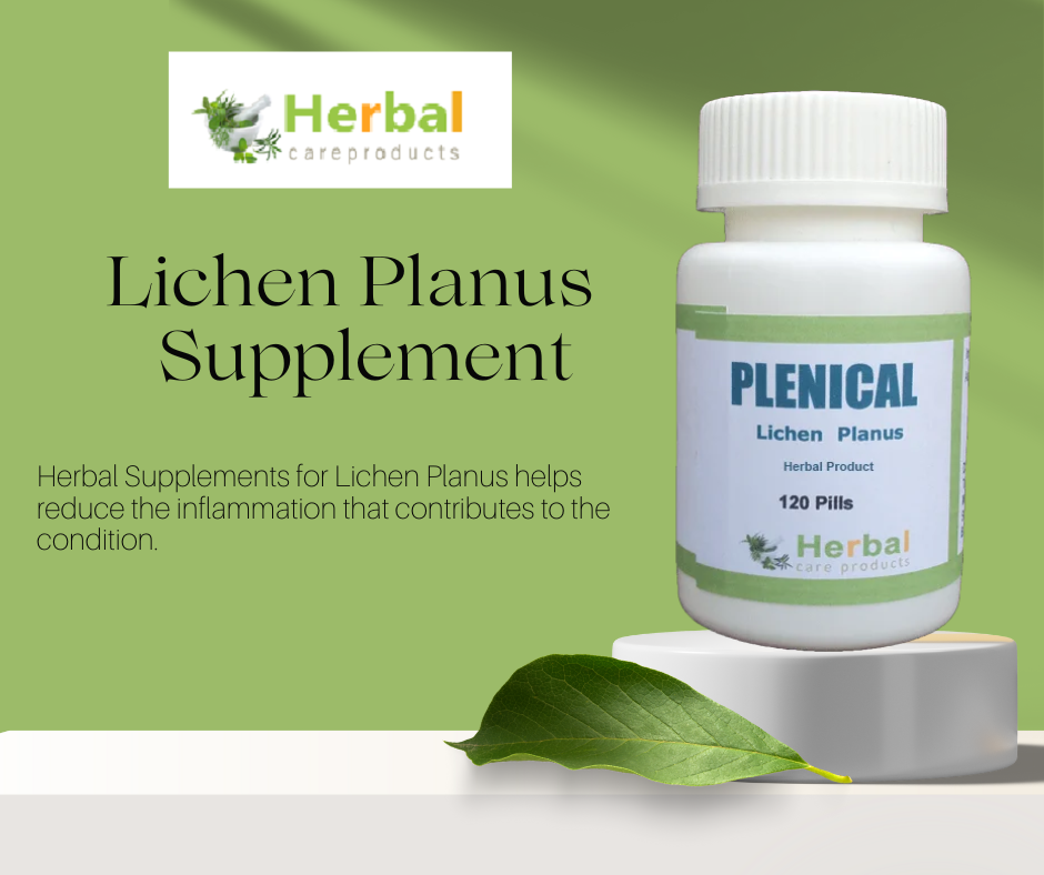 Supplements for Lichen Planus