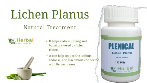 Supplements for Lichen Planus - Copy