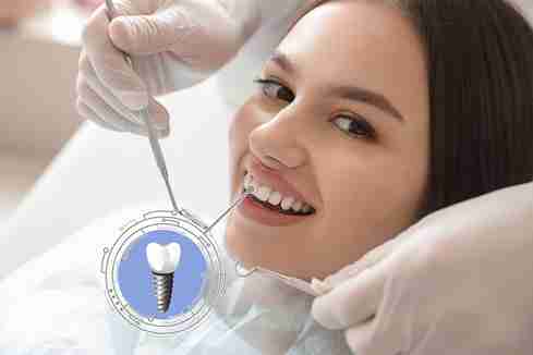 The Lifespan of Dental Implants How Long Do They Last_11zon
