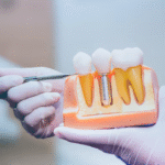 implant dentistry spanish fort al