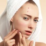 Woman with pimples using pimple clear face wash