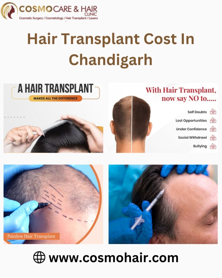 Hair Transplant Cost in Chandigarh