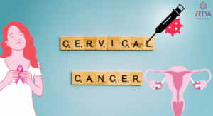 Cervical Cancer Treatment in Noida