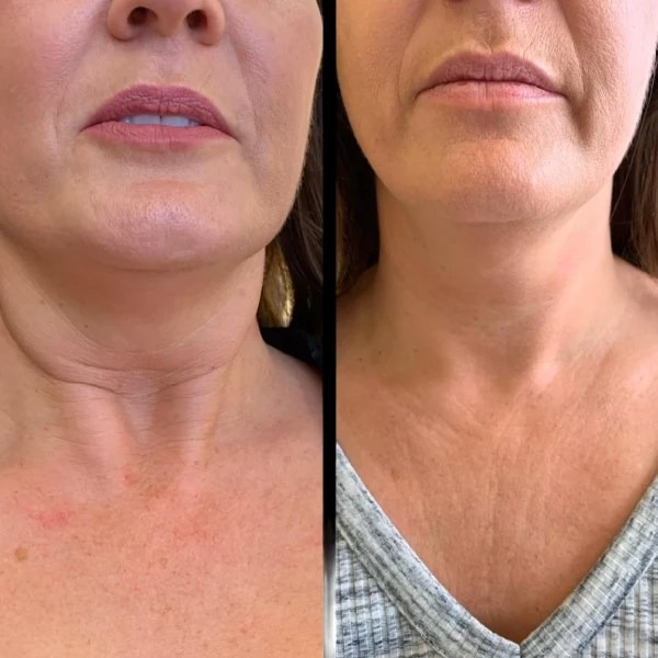 Best Aesthetic Clinic in dubai