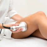 Safe Laser Hair Removal