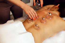Cupping Massage Near Me