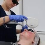 Laser For Pigmentation In London