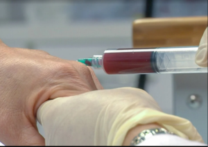 Prp Injections In Dubai