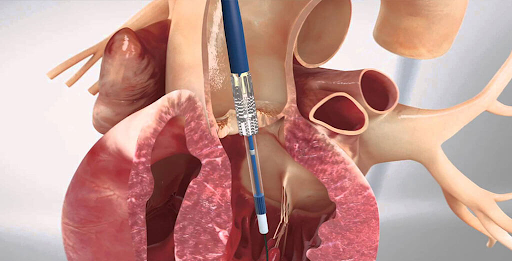 unnamed - 2026-02-18T152300.808