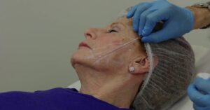 thread lift in islamabad