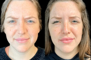 Best Aesthetic Clinics in Dubai for Non-Surgical Botox Procedures