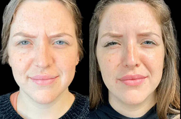 Best Aesthetic Clinics in Dubai for Non-Surgical Botox Procedures