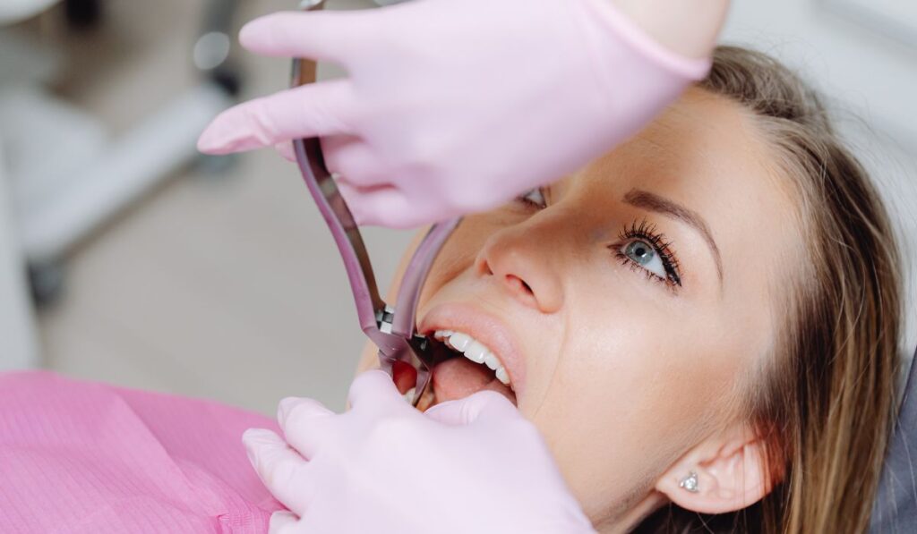 Teeth Bleaching
