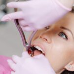 Teeth Bleaching