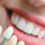 Italian Dental Clinic Dubai