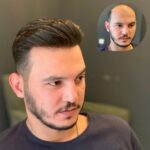 hair wig for men