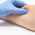 lipoma treatment in islamabad