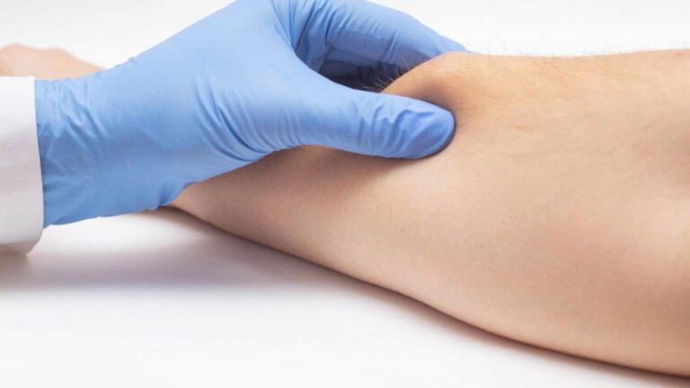 lipoma treatment in islamabad