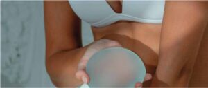 breast-augmentation-pic02