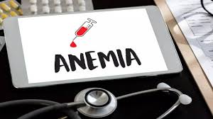 Anemia