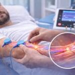 peripheral nerve repair.