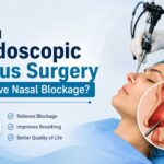 Endoscopic Sinus Surgery treatment in Gurgaon