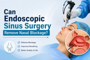 Endoscopic Sinus Surgery treatment in Gurgaon