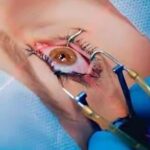 LASIK Surgery in Delhi at Shreya Eye Centre for safe and advanced laser vision correction to improve eyesight and reduce dependency on glasses.