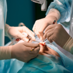 Reconstructive-Surgery-