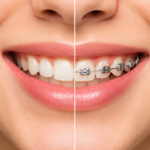 braces Arlington Heights IL