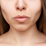 buccal fat removal in Islamabad