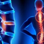 detail-main-spine-disorders