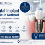 Dental Implant Clinic in Kothrud