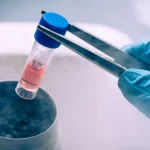 Stem Cells in Dubai