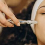 The-Ultimate-Guide-To-Microneedling-Procedures-400x250