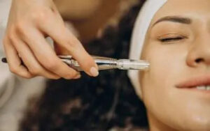 The-Ultimate-Guide-To-Microneedling-Procedures-400x250