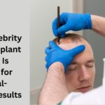 celebrity hair transplant doctor
