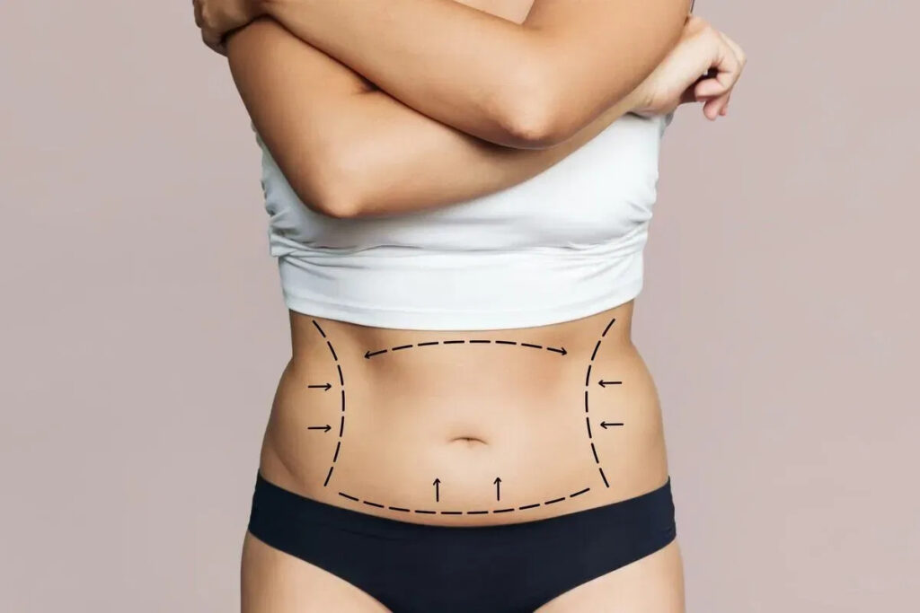 Abdominal surgery in India