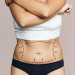 Abdominal surgery in India