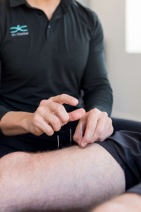 dry needling training course