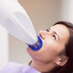 teeth whitening in Burbank