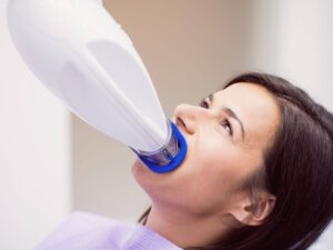 teeth whitening in Burbank