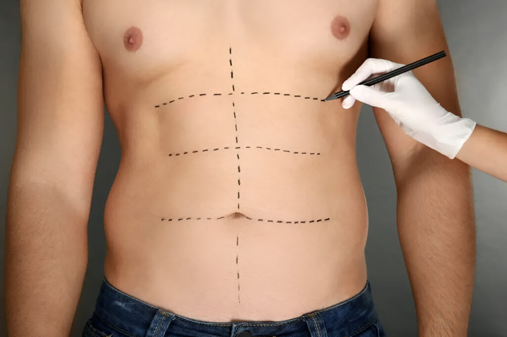 tummy tuck surgery in islamabad