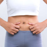 Liposuction in Dubai