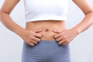 Liposuction in Dubai