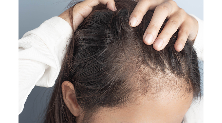 Personalized Hair Loss Consultation Dallas/Private Hair Loss Consultation Dallas