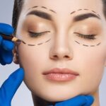 blepharoplasty surgery in India