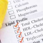 Cholesterol Test