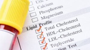 Cholesterol Test