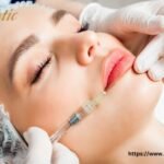 Lip Fillers Riverside